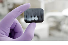 Get to know gum disease | Philips
